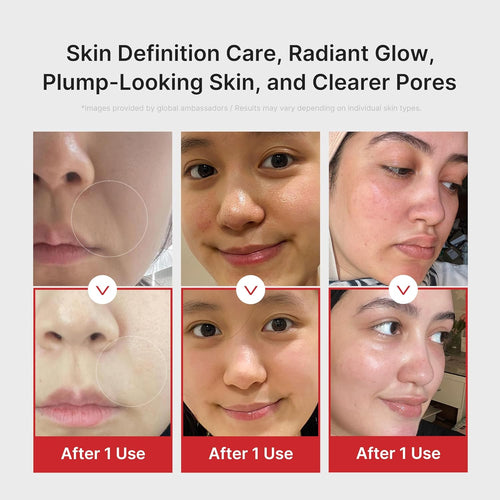 AGE-R Booster-H |  K-beauty Glow Booster Device