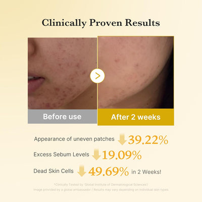 Kojic Acid Turmeric Power Duo